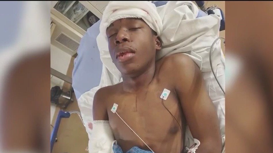 Teen shot by homeowner in possible case of mistaken identity: Missouri police